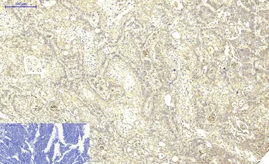 Anti-ABCB5 antibody [11A2] used in IHC (Paraffin sections) (IHC-P). GTX34025