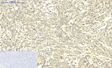 Anti-ABCB5 antibody [11A2] used in IHC (Paraffin sections) (IHC-P). GTX34025