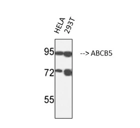 Anti-ABCB5 antibody [11A2] used in Western Blot (WB). GTX34025