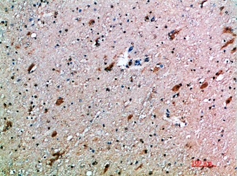 Anti-NKG2D antibody used in IHC (Paraffin sections) (IHC-P). GTX34027