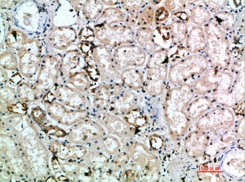 Anti-NKG2D antibody used in IHC (Paraffin sections) (IHC-P). GTX34027