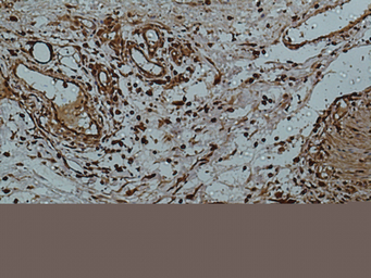 Anti-Galectin 3 antibody [8D7] used in IHC (Paraffin sections) (IHC-P). GTX34031