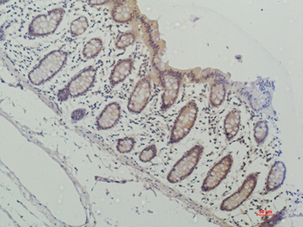 Anti-Galectin 3 antibody [16E6] used in IHC (Paraffin sections) (IHC-P). GTX34034