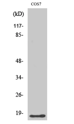 Anti-LMO3 antibody used in Western Blot (WB). GTX34040