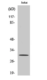 Anti-ATF5 antibody used in Western Blot (WB). GTX34045
