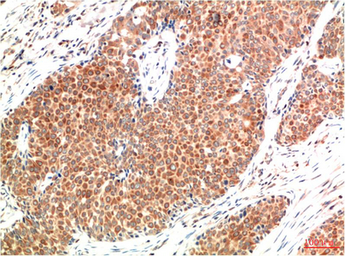 Anti-ATM antibody [1D1] used in IHC (Paraffin sections) (IHC-P). GTX34046
