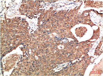 Anti-ATM antibody [3D3] used in IHC (Paraffin sections) (IHC-P). GTX34048