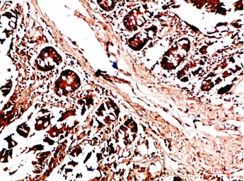 Anti-HLA-DQA1 antibody used in IHC (Paraffin sections) (IHC-P). GTX34049