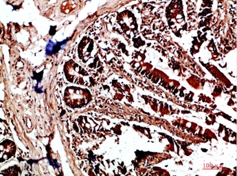 Anti-HLA-DQA1 antibody used in IHC (Paraffin sections) (IHC-P). GTX34049