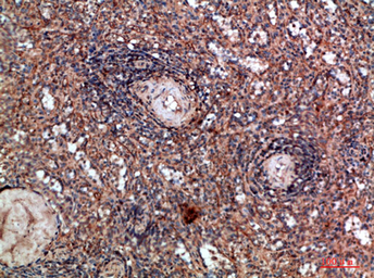 Anti-HLA-DQA1 antibody used in IHC (Paraffin sections) (IHC-P). GTX34049