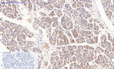 Anti-Bax antibody [6F11] used in IHC (Paraffin sections) (IHC-P). GTX34052
