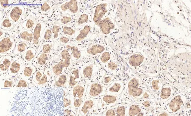 Anti-Bax antibody [6F11] used in IHC (Paraffin sections) (IHC-P). GTX34052
