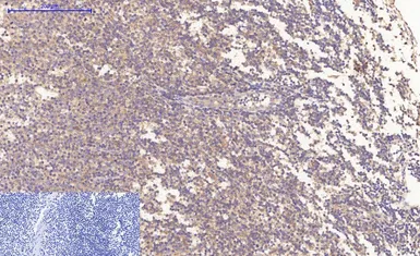 Anti-Bax antibody [6F11] used in IHC (Paraffin sections) (IHC-P). GTX34052