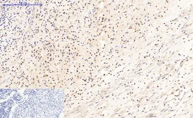Anti-Bax antibody [6F11] used in IHC (Paraffin sections) (IHC-P). GTX34052