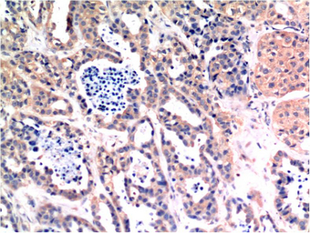 Anti-Bax antibody [6F11] used in IHC (Paraffin sections) (IHC-P). GTX34052