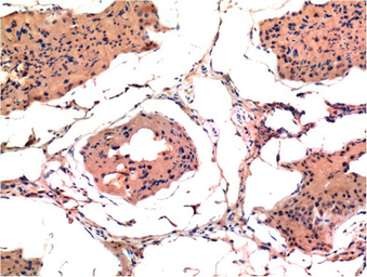 Anti-Bax antibody [6F11] used in IHC (Paraffin sections) (IHC-P). GTX34052