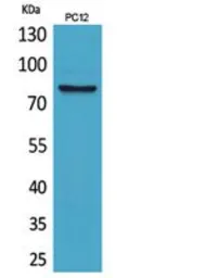 Anti-CD239 antibody used in Western Blot (WB). GTX34054