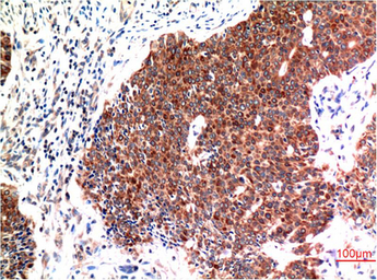 Anti-Beclin 1 antibody [5C2] used in IHC (Paraffin sections) (IHC-P). GTX34055