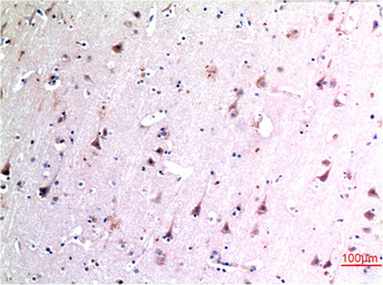 Anti-Beclin 1 antibody [5A11] used in IHC (Paraffin sections) (IHC-P). GTX34056