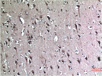 Anti-Beclin 1 antibody [5C5] used in IHC (Paraffin sections) (IHC-P). GTX34057