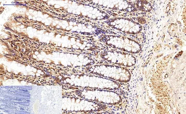 Anti-Survivin antibody [Mix] used in IHC (Paraffin sections) (IHC-P). GTX34059