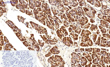 Anti-Survivin antibody [Mix] used in IHC (Paraffin sections) (IHC-P). GTX34059
