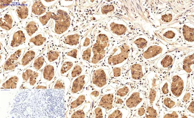 Anti-Survivin antibody [Mix] used in IHC (Paraffin sections) (IHC-P). GTX34059