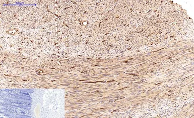 Anti-Survivin antibody [Mix] used in IHC (Paraffin sections) (IHC-P). GTX34059