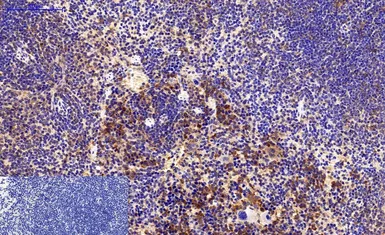 Anti-Survivin antibody [Mix] used in IHC (Paraffin sections) (IHC-P). GTX34059