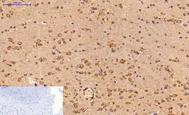Anti-Survivin antibody [Mix] used in IHC (Paraffin sections) (IHC-P). GTX34059