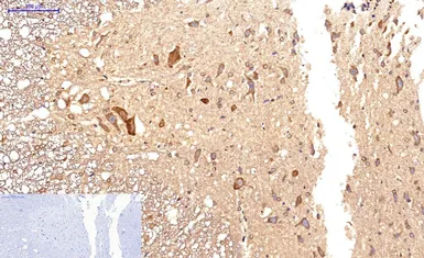 Anti-Survivin antibody [Mix] used in IHC (Paraffin sections) (IHC-P). GTX34059