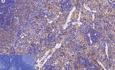 Anti-Survivin antibody [Mix] used in IHC (Paraffin sections) (IHC-P). GTX34059