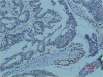 Anti-Survivin antibody [Mix] used in IHC (Paraffin sections) (IHC-P). GTX34059