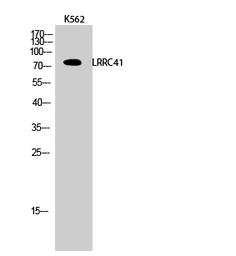 Anti-LRRC41 antibody used in Western Blot (WB). GTX34065