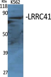Anti-LRRC41 antibody used in Western Blot (WB). GTX34065