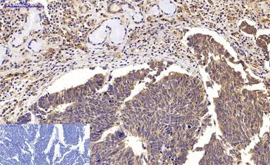 Anti-LC3A antibody [5G10] used in IHC (Paraffin sections) (IHC-P). GTX34067