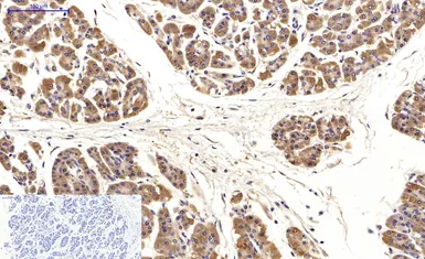 Anti-LC3A antibody [5G10] used in IHC (Paraffin sections) (IHC-P). GTX34067