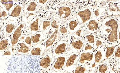 Anti-LC3A antibody [5G10] used in IHC (Paraffin sections) (IHC-P). GTX34067