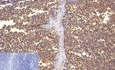 Anti-LC3A antibody [5G10] used in IHC (Paraffin sections) (IHC-P). GTX34067