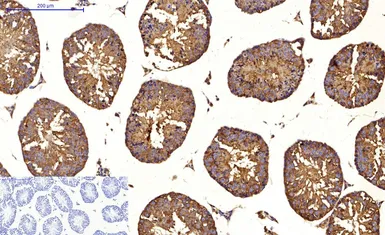 Anti-LC3A antibody [5G10] used in IHC (Paraffin sections) (IHC-P). GTX34067