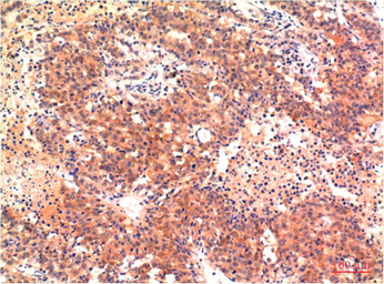 Anti-LC3A antibody [5G10] used in IHC (Paraffin sections) (IHC-P). GTX34067