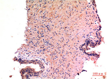 Anti-LC3A antibody [5G10] used in IHC (Paraffin sections) (IHC-P). GTX34067
