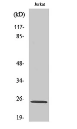 Anti-MDFI antibody used in Western Blot (WB). GTX34074