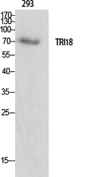 Anti-Midline-1 antibody used in Western Blot (WB). GTX34076
