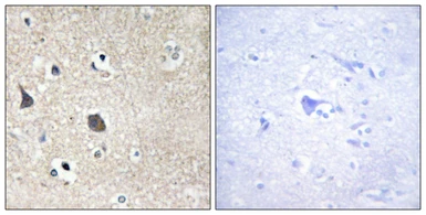 Anti-Midline-1 antibody used in IHC (Paraffin sections) (IHC-P). GTX34076
