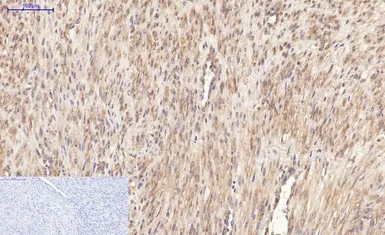 Anti-Ki67 antibody [4A8] used in IHC (Paraffin sections) (IHC-P). GTX34077