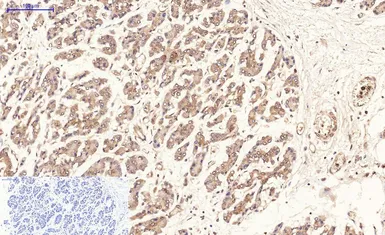 Anti-Ki67 antibody [4A8] used in IHC (Paraffin sections) (IHC-P). GTX34077