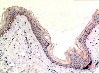 Anti-MLKL antibody [8H7] used in IHC (Paraffin sections) (IHC-P). GTX34079