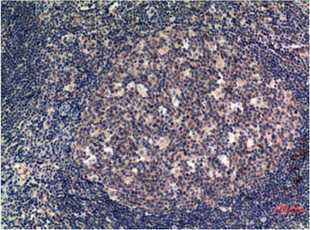 Anti-MLKL antibody [8H7] used in IHC (Paraffin sections) (IHC-P). GTX34079