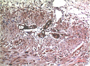 Anti-MMP2 antibody [1H1] used in IHC (Paraffin sections) (IHC-P). GTX34081